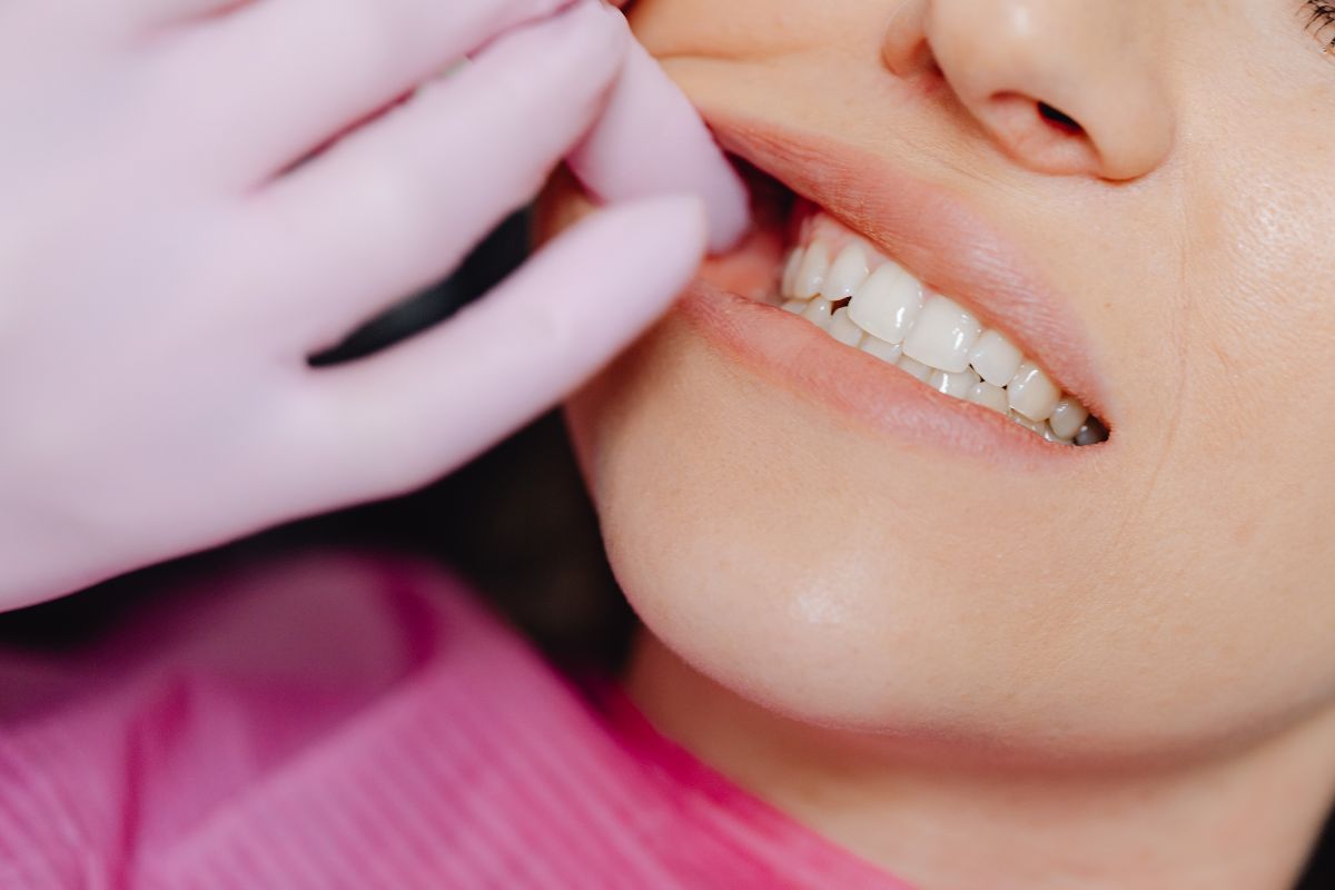 I denti devitalizzati diventano neri? Come risolvere il problema