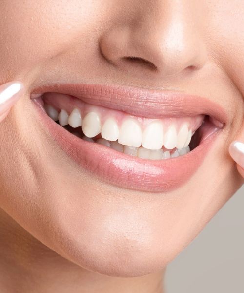 ricostruzione estetica denti milano