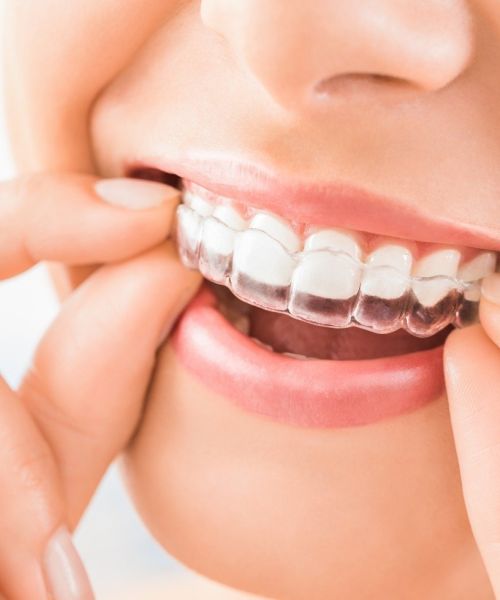 ricostruzione estetica denti milano